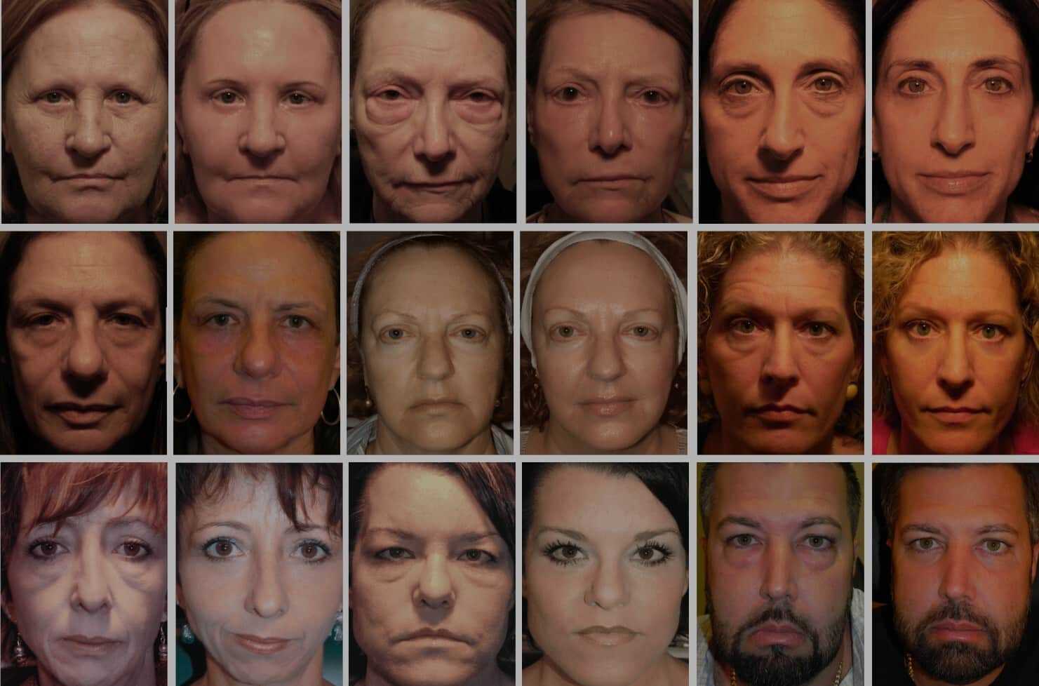 Collage of before and after transformations with amazing results.